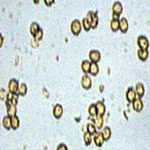 false smut spores